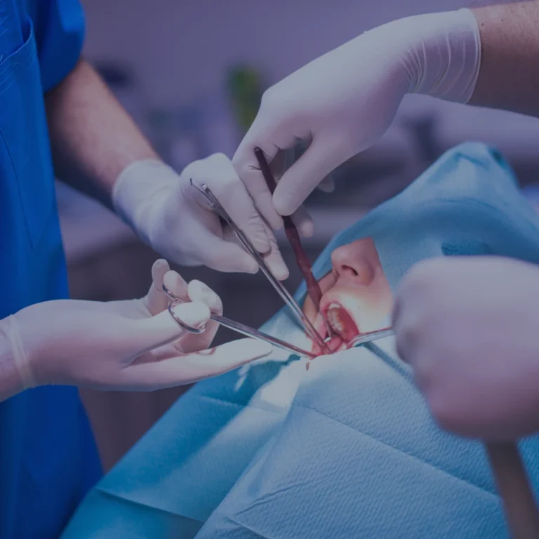 komplikovano-vadjenje-zuba-novi-sad